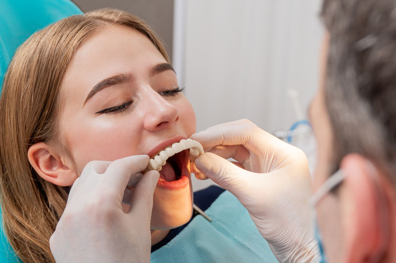 an image of a patient in the process of getting full mouth dental implants. She is at the step of the full mouth dental implant proses where the prosthetic is cemented into place.